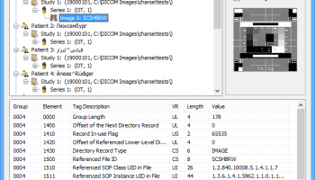 Sante DICOMDIR Viewer screenshot