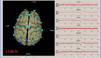 Visualization Toolkit (VTK) screenshot