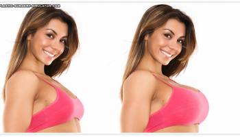 Plastic Surgery Simulator screenshot