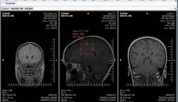 XRayline Workstation screenshot
