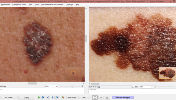 Photo Side-by-Side screenshot