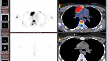 RadiAnt Viewer screenshot