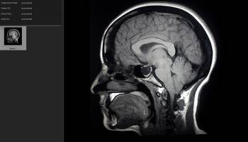 SeePlus DICOM screenshot